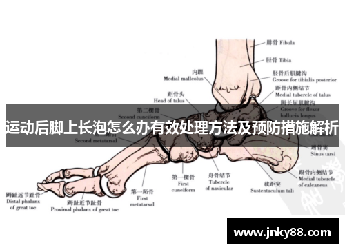 运动后脚上长泡怎么办有效处理方法及预防措施解析
